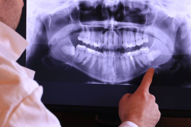 Best Emergency Dentist for Lost Fillings or Crowns in Braddock, VA
