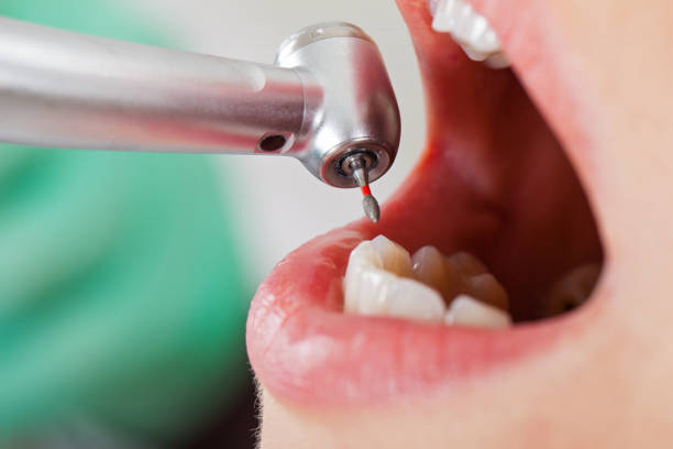Best Urgent Dental Care for Toothache in Braddock, VA